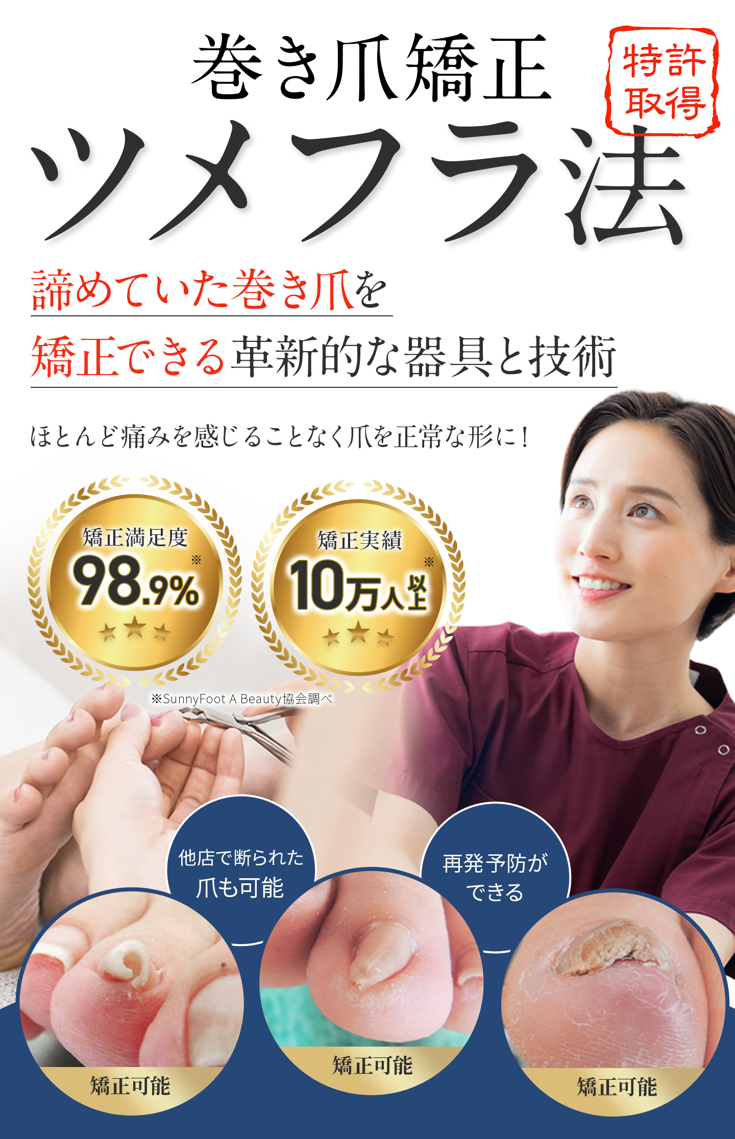 巻き爪矯正の革新技術、ツメフラ法