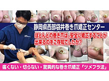 静岡県西部袋井巻き爪矯正センター