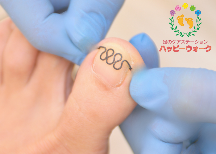 足のケアステーションハッピーウォーク