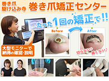 横浜・元町巻き爪矯正センター